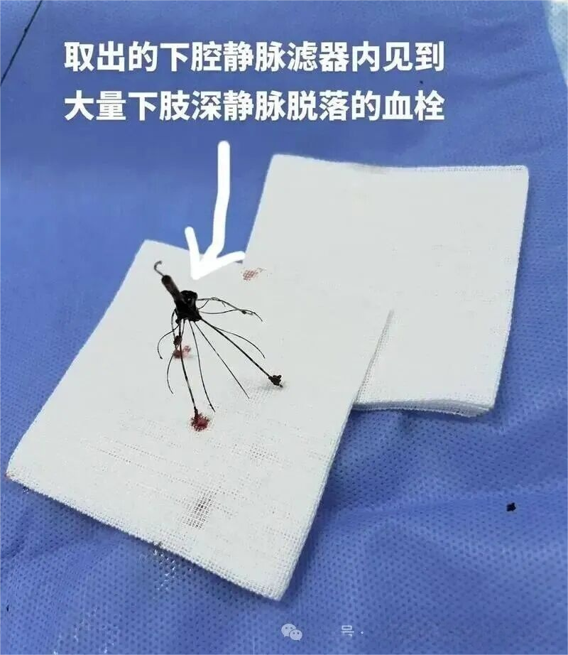 看病走新路 医学有介入 | 微…